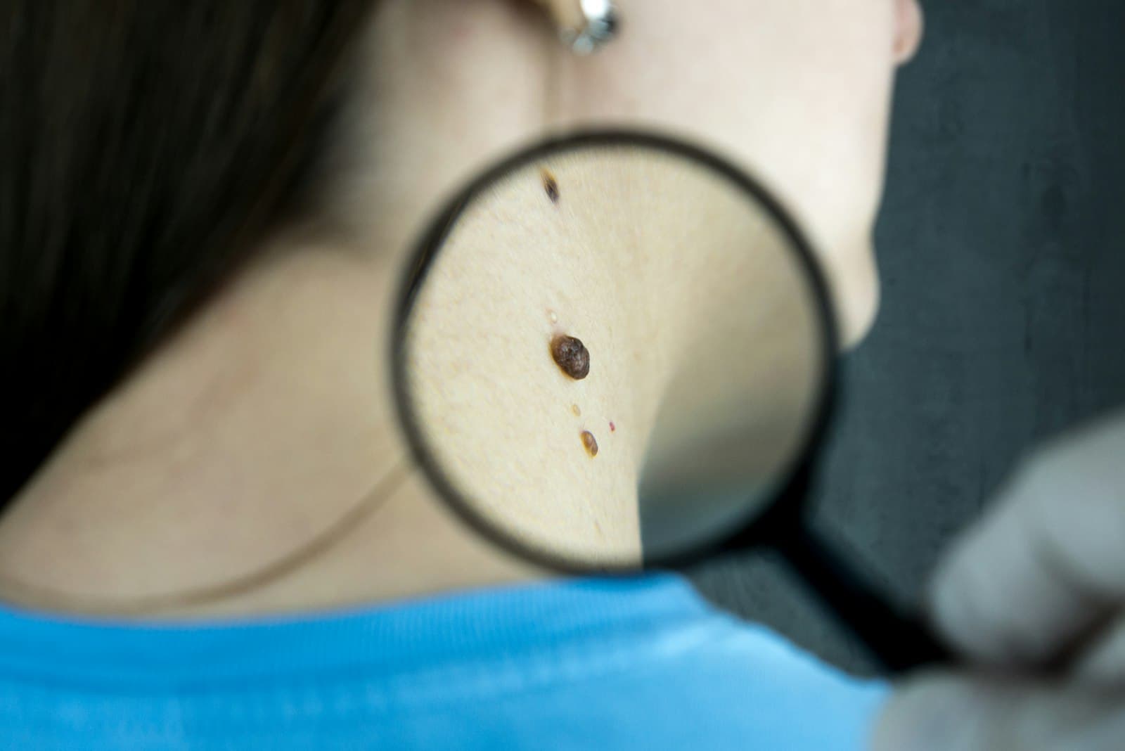 Consultorio de dermatología en Lucero Consultorios Médicos